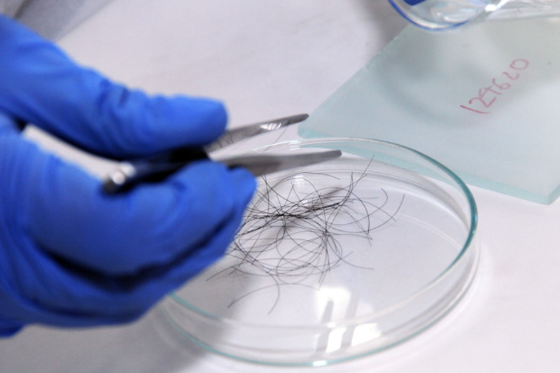 ​Xét nghiệm ADN bằng tóc