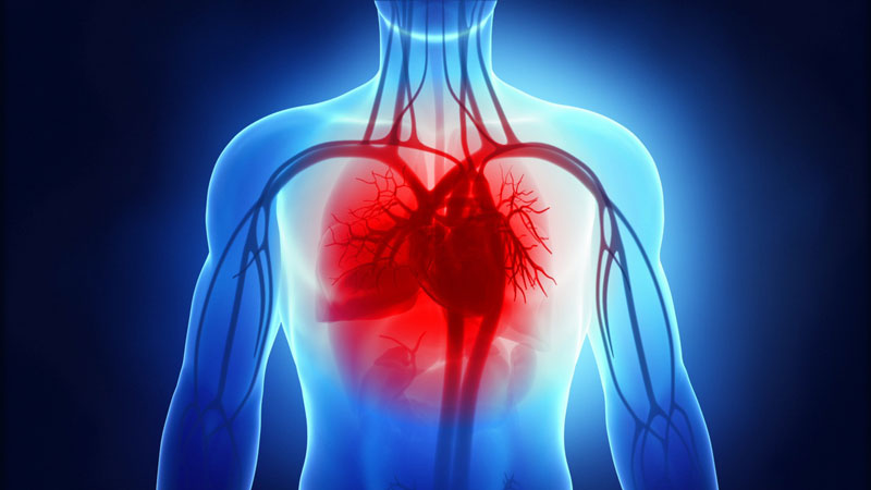 Suy tim là biến chứng thường gặp của bệnh nhân huyết áp cao