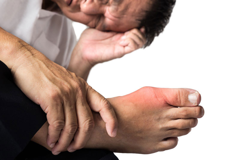 bệnh gout có thể gây ra nhiều biến chứng nguy hiểm