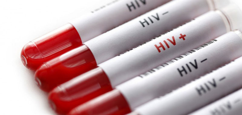 Xét nghiệm HIV là điều cần thiết nếu nghi ngờ bị nhiễm bệnh