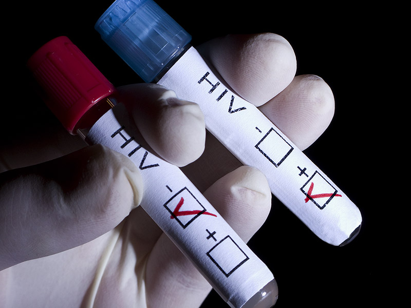 Xét nghiệm khẳng định HIV sau khoảng 24 giờ mới có kết quả