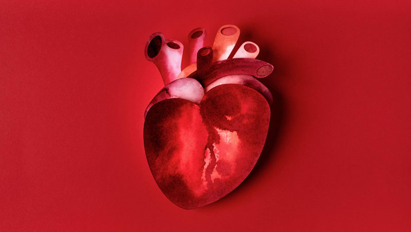 Thiếu máu cơ tim là một trong những biến chứng thường gặp