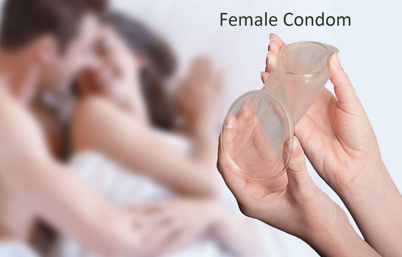 Bao cao su nữ được đặt vào bên trong âm đạo không cho tinh dịch di chuyển vào tử cung