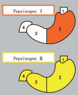 Hình 1. Sự sản xuất pepsinogen I (màu đỏ) và pepsinogen 2 (màu vàng) ở các vùng khác nhau của dạ dày và hành tá tràng: 1) vùng tâm vị (cardia), 2) vùng đáy vị (fundus), 3) vùng hang môn vị (pylonic antrum), 4) hành tá tràng (duodenum).