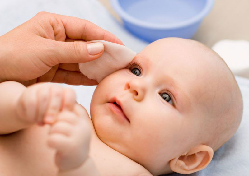 Tắc tuyến lệ là bệnh mắt thường gặp ở trẻ em