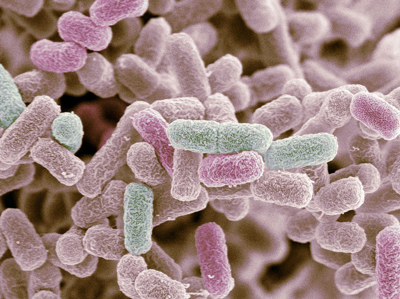 Đa số vi khuẩn e coli đều có lợi cho hệ tiêu hóa