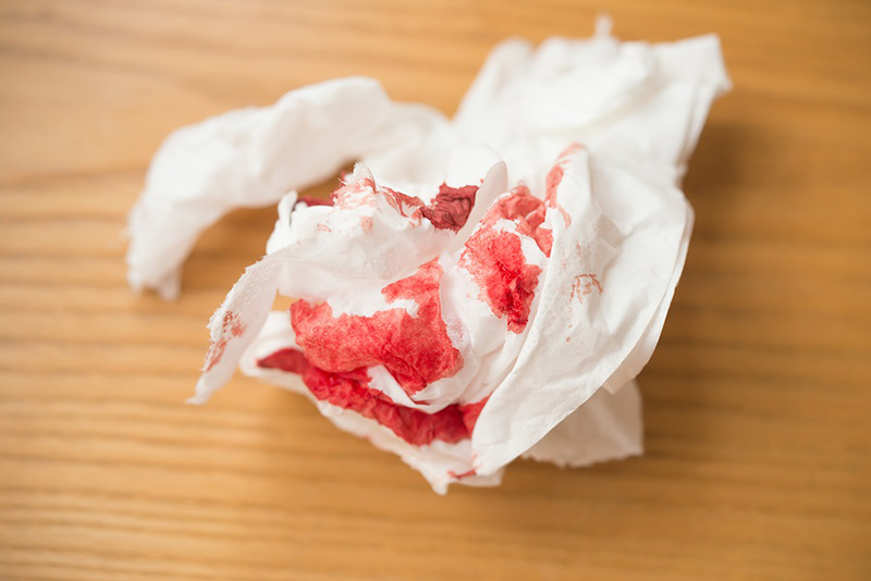Người bệnh có thể nhận thấy máu dính ở phân hay giấy vệ sinh