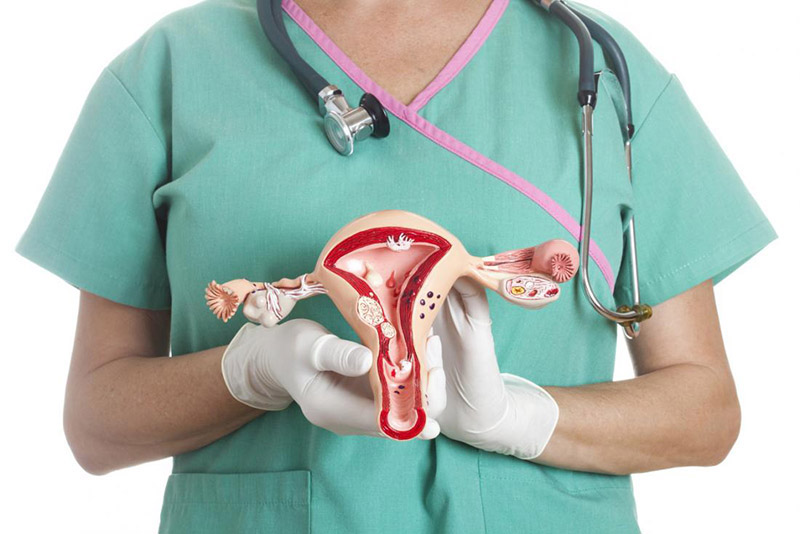 Polyp tử cung là bệnh lý lành tính, có thể điều trị dứt điểm