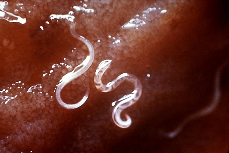 giun móc là bệnh do ký sinh trùng gây ra