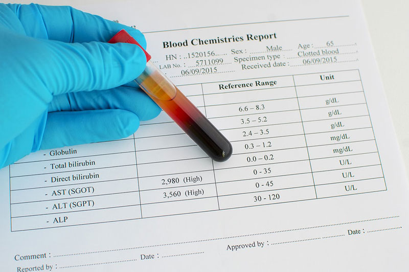 Xét nghiệm máu đo lường chỉ số AST