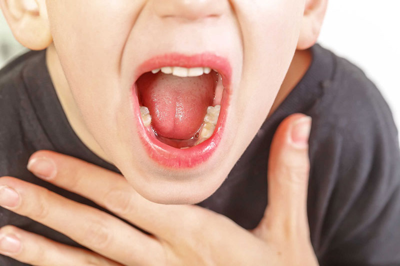 Viêm họng là bệnh thường gặp trong cuộc sống