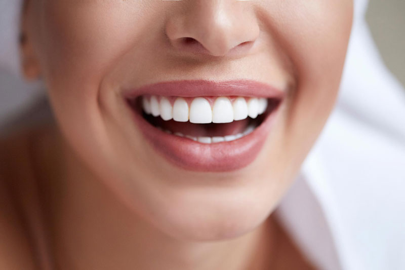 Tẩy trắng răng hoàn toàn không gây cảm giác đau