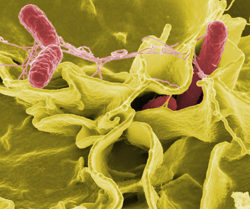 Salmonella typhi được xác định là nguyên nhân gây sốt thương hàn