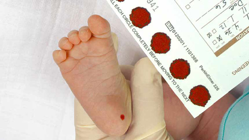 Xét nghiệm sàng lọc sơ sinh được thực hiện bằng cách lấy máu gót chân