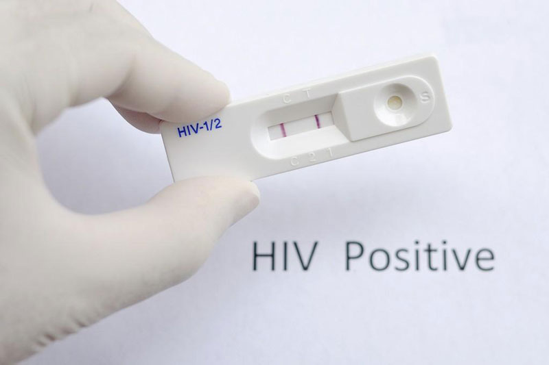 Cần làm xét nghiệm định kỳ nếu bạn có nguy cơ cao lây nhiễm HIV
