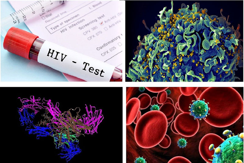 Xét nghiệm HIV là phương pháp tối ưu để phát hiện ra bệnh