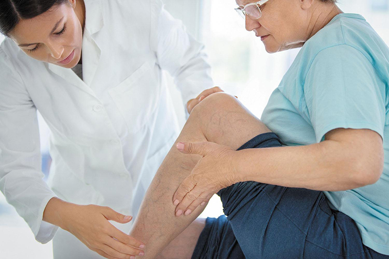 Tùy trường hợp bác sĩ sẽ cho chỉ định điều trị giãn tĩnh mạch chân ở nữ giới