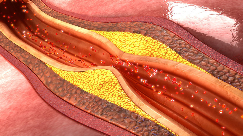 Kỹ thuật siêu âm doppler giúp xác định các bệnh lý mạch máu 
