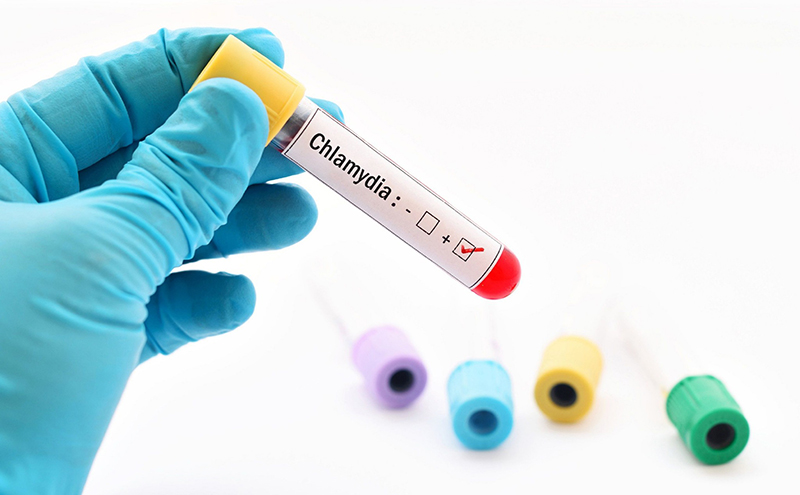 Trong nhiều trường hợp cần thiết, bác sĩ có thể cho chỉ định các phương pháp xét nghiệm chuyên sâu để chẩn đoán bệnh Chlamydia 