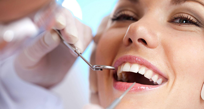 Lấy cao răng định kỳ là cách tốt nhất để chăm sóc sức khỏe răng miệng hạn chế chảy máu chân răng