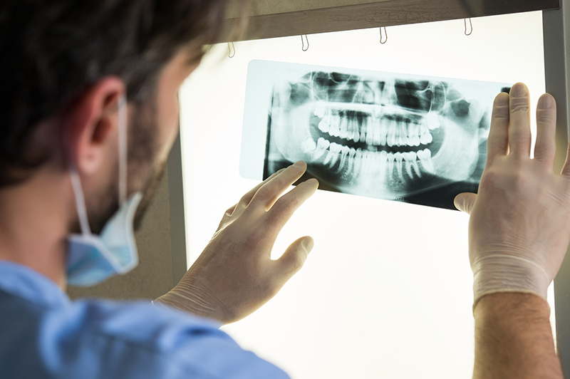 Bác sĩ sử dụng phương pháp chụp X-quang để phân tích tình trạng răng