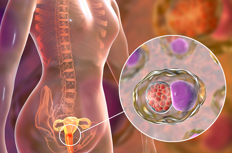 Virus HPV được xác định là nguyên nhân chủ yếu gây bệnh ung thư cổ tử cung