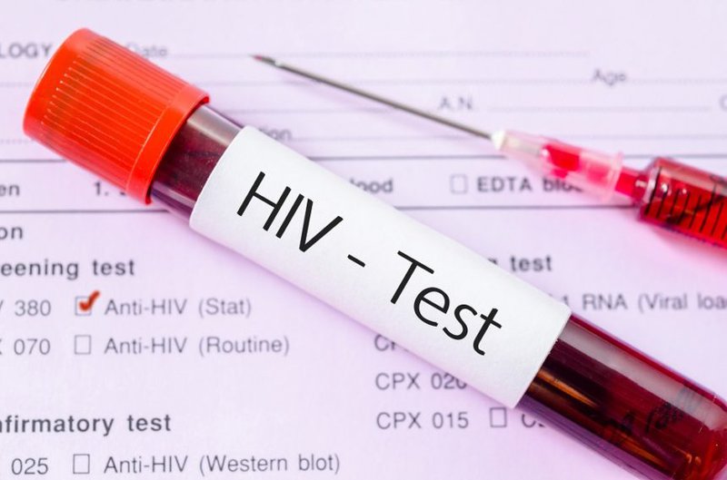 Xét nghiệm HIV giúp phát hiện bệnh một cách chính xác