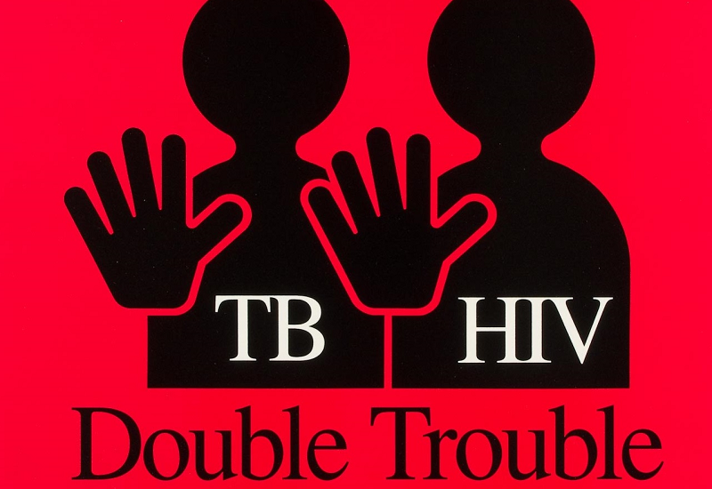 Người bệnh bị nhiễm HIV có thể là yếu tố nguy cơ dẫn đến bệnh lao