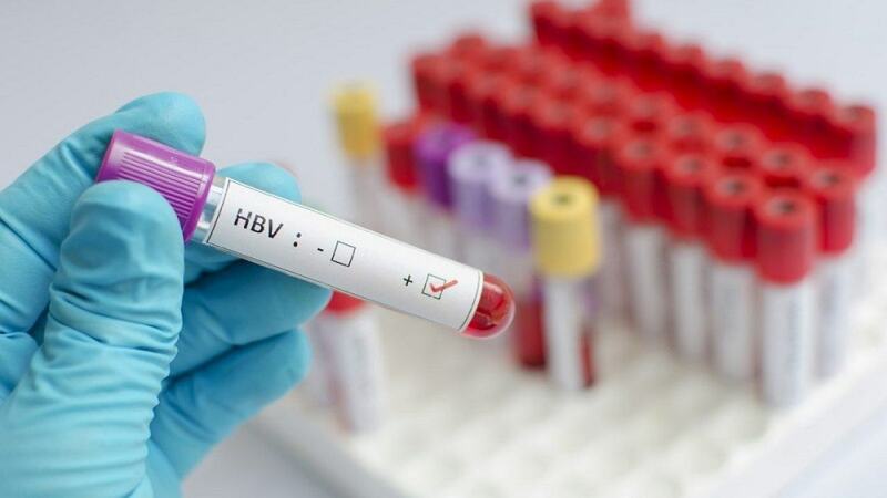 Xét nghiệm HbsAg giúp xác định người bệnh có nhiễm virus viêm gan B không