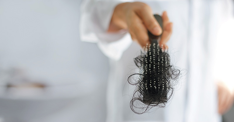 Có nhiều nguyên nhân gây rụng tóc nhiều ở nữ