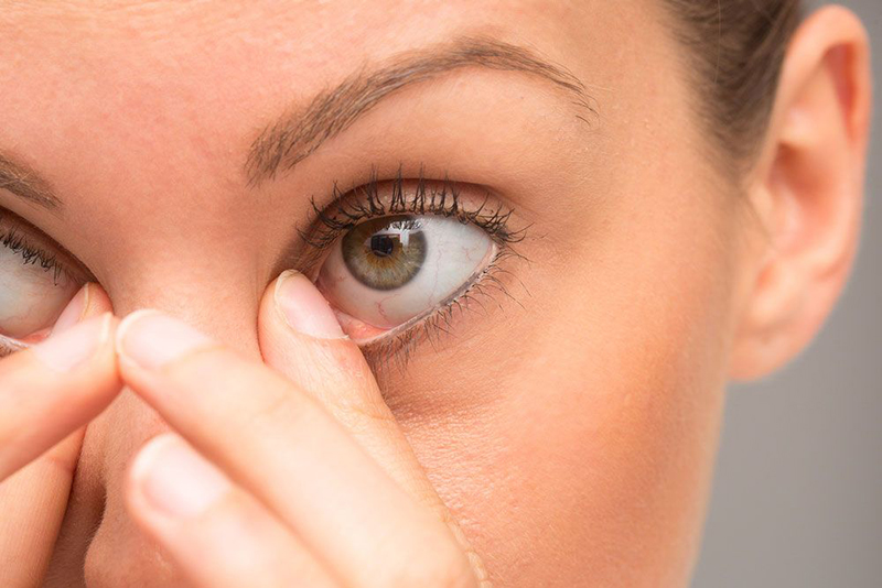 viêm kết mạc dị ứng nên hạn chế dụi mắt