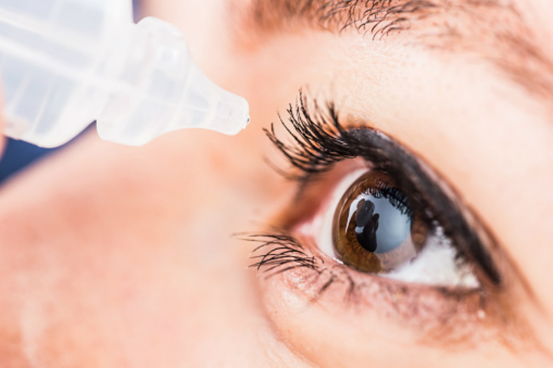 Thuốc nhỏ mắt có thể làm giảm nhẹ các triệu chứng gây ra khi kết mạc mắt bị dị ứng