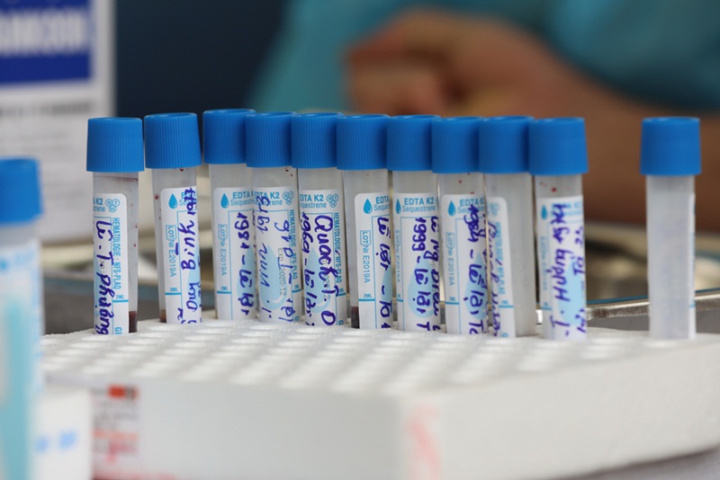 Xét nghiệm PCR giúp phát hiện nhiều bệnh lý nguy hiểm