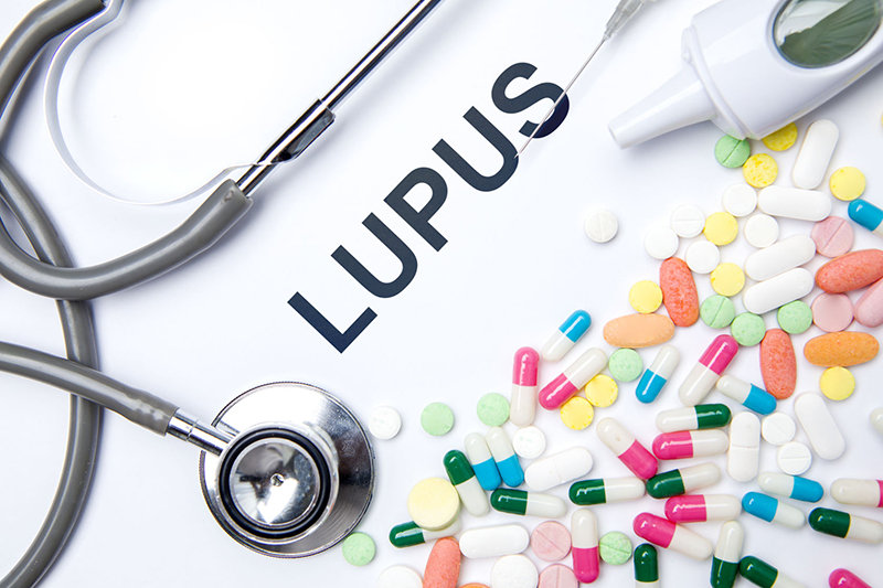 Cách chữa trị bệnh Lupus ban đỏ khi có biến chứng phủ tạng thường để lại nhiều tác dụng phụ nên cần sự tư vấn cụ thể của chuyên gia 