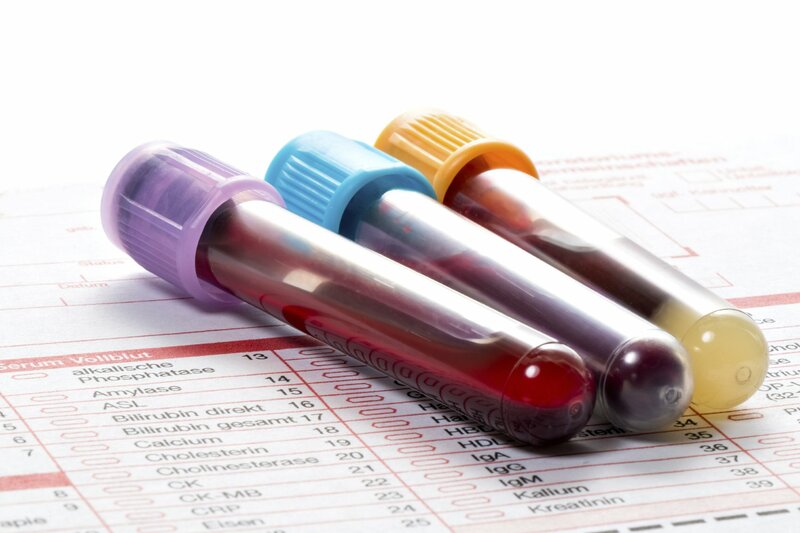 Xét nghiệm sinh hóa máu thường dùng trong thăm khám bệnh