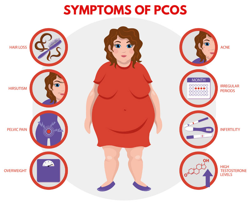 Hội chứng PCOS là nguyên nhân khiến khí hư đổi màu