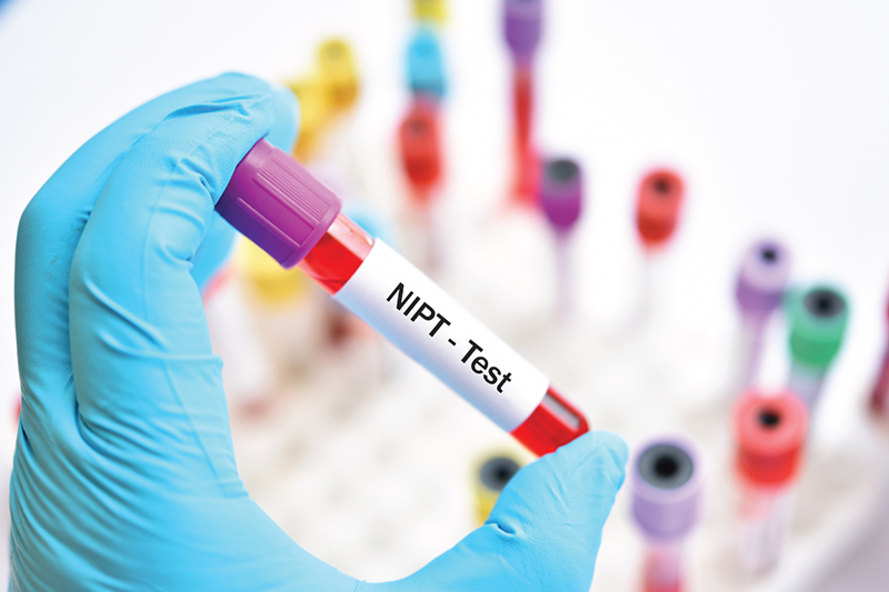 Phương pháp sàng lọc NIPT giúp chẩn đoán hội chứng Patau ở thai nhi mới nhất 