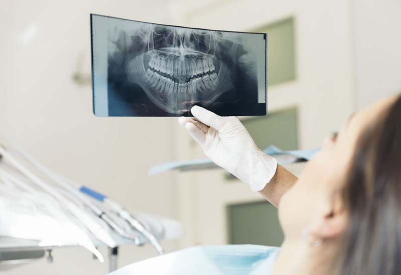 Chụp X-quang là phương pháp tốt nhất để chẩn đoán áp xe răng
