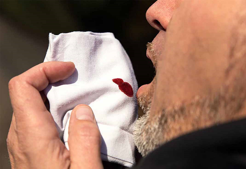 Một trong những dấu hiệu nhận biết ung thư vòm họng chính là tình trạng ho ra máu
