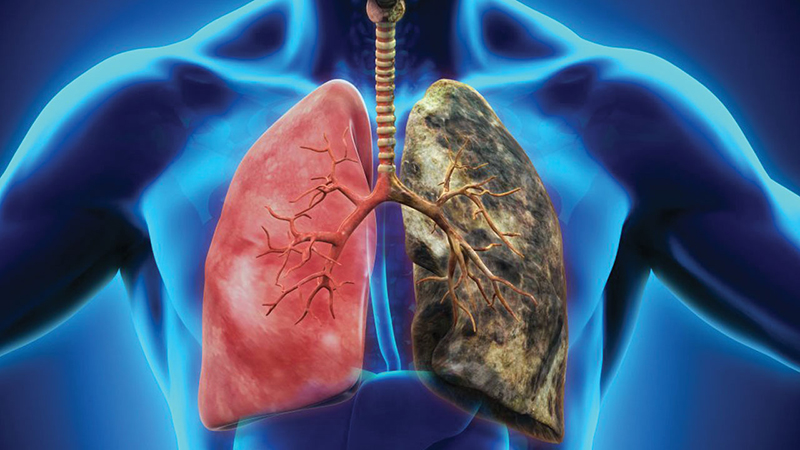 Tác hại của thuốc lá rõ nhất là có thể xâm lấn vào phổi và hình thành các tế bào ung thư
