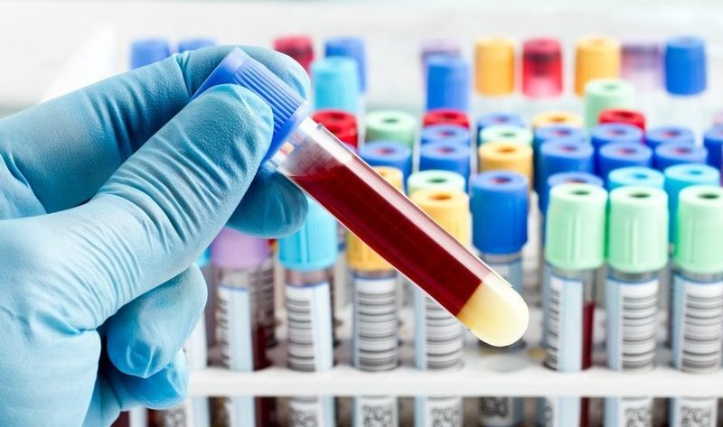 Xét nghiệm máu giúp chẩn đoán bệnh máu khó đông