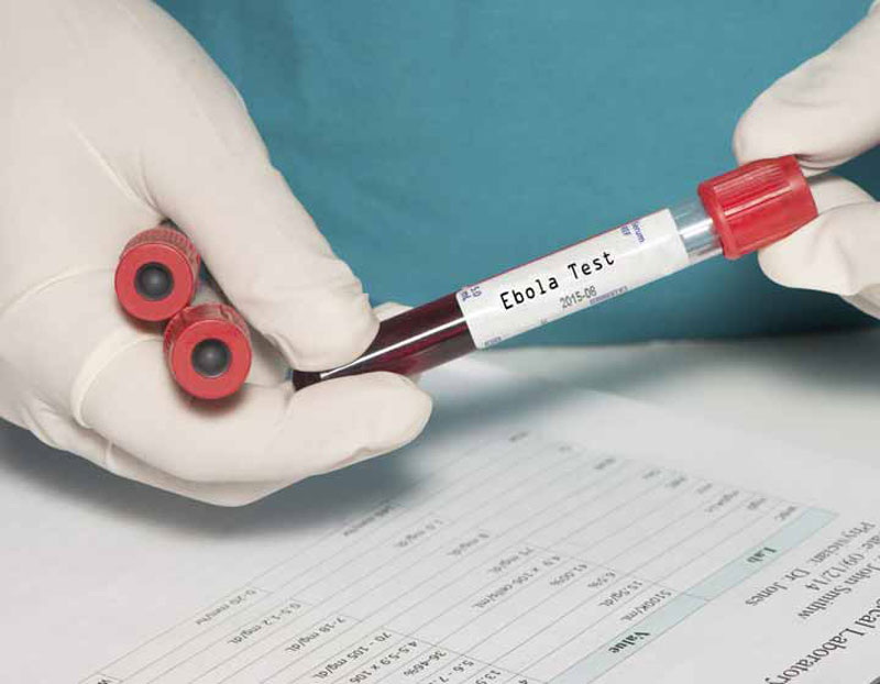 Xét nghiệm kháng nguyên để xác định virus gây bệnh