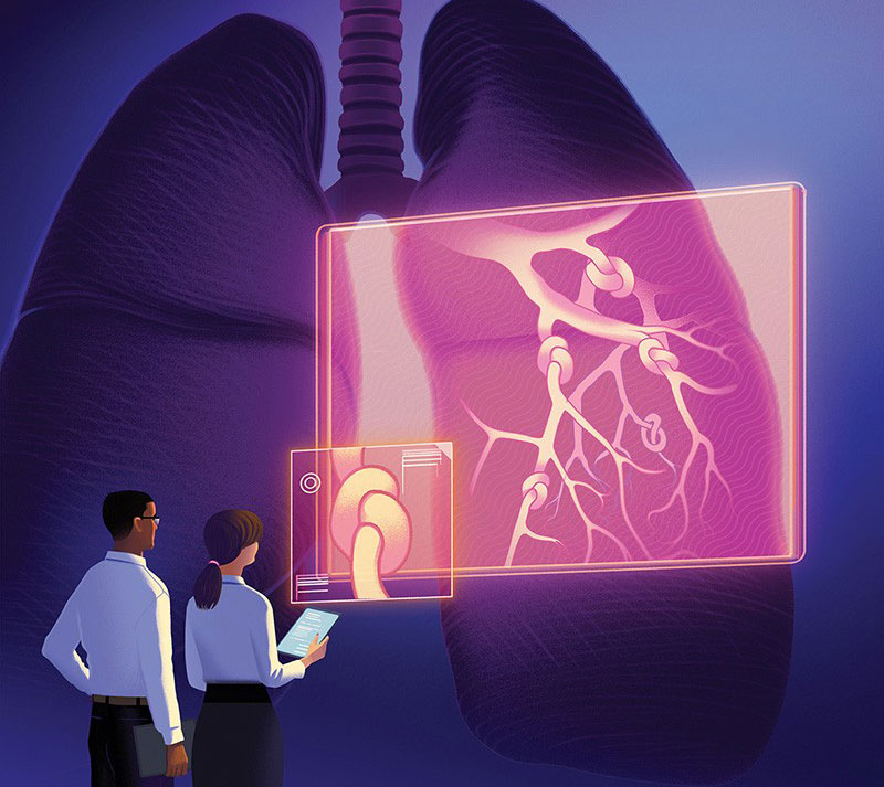 Các phương pháp điều trị cho bệnh nhân bị COPD