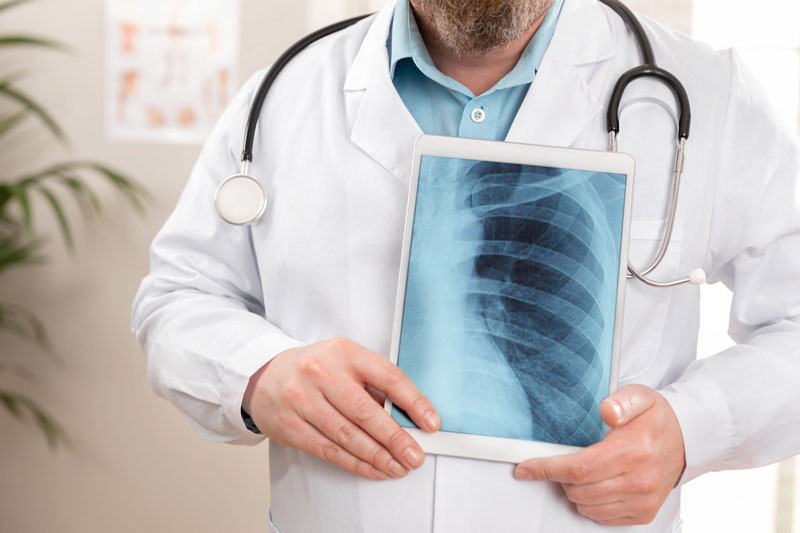 Tích cực chữa trị các bệnh lý liên quan đến phổi