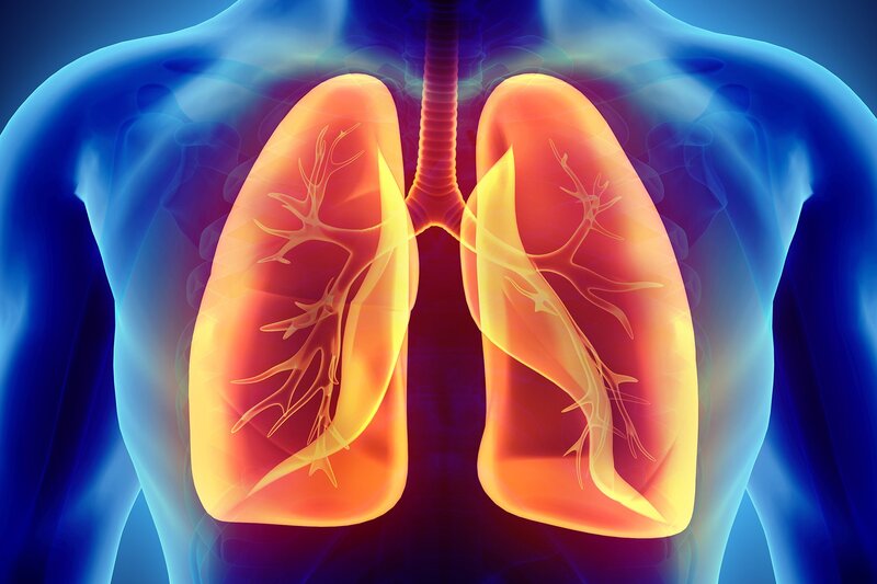 hội chứng tràn khí màng phổi