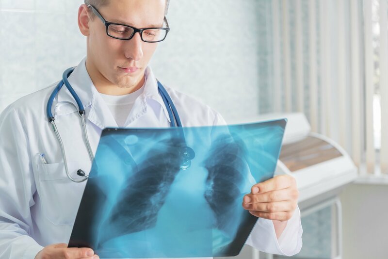 Chụp X-quang thường chỉ định trong chẩn đoán tràn khí màng phổi