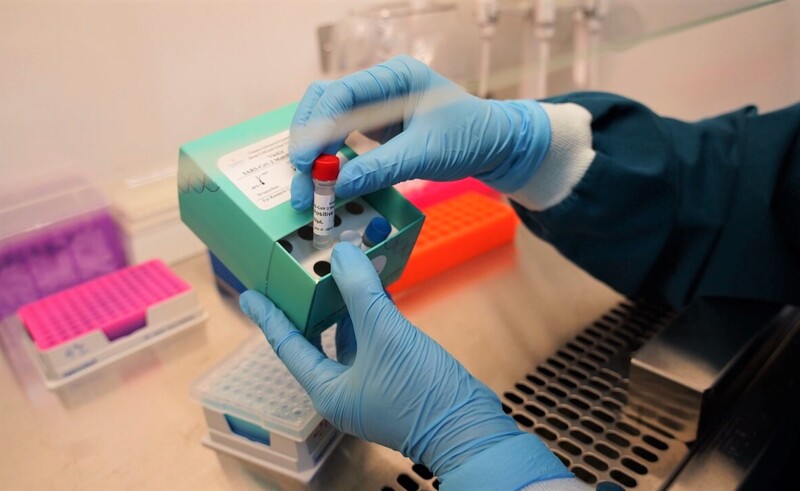 Phương pháp PCR cho kết quả chính xác, giá trị cao trong chẩn đoán