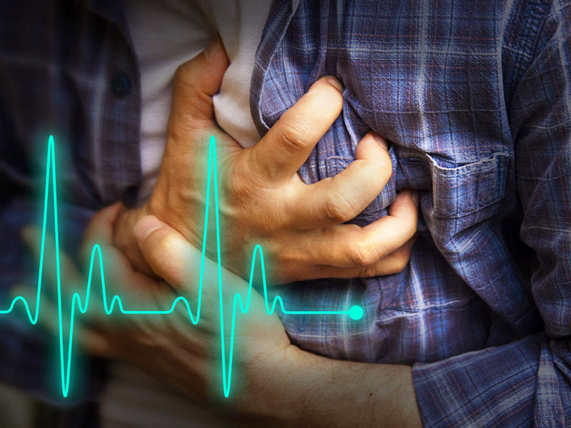 Xơ vữa động mạch vành là nguyên nhân chính gây bệnh nhồi máu cơ tim
