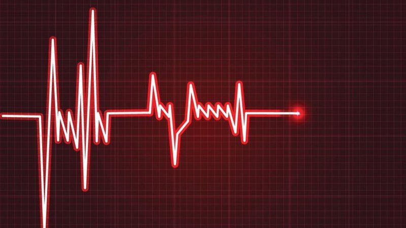 Điện tâm đồ là phương pháp để chẩn đoán viêm cơ tim