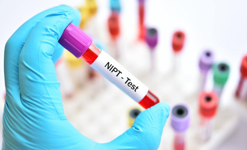  Xét nghiệm NIPT dựa trên phân tích ADN thai trong máu mẹ